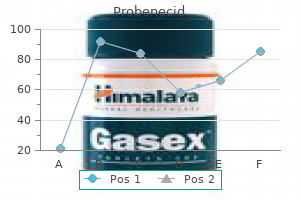 buy probenecid now