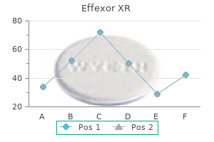 buy cheap effexor xr 37.5mg line