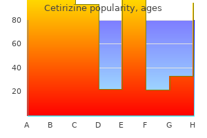 order generic cetirizine on line