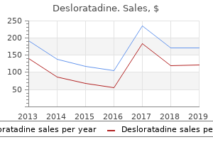 desloratadine 5mg sale