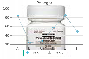 order penegra 50mg otc