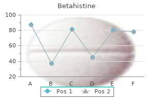 order betahistine online from canada