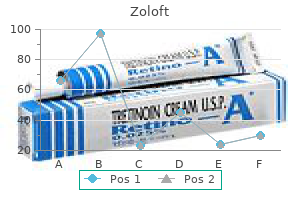 buy zoloft 25 mg mastercard