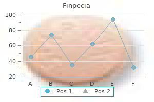 buy finpecia 1 mg free shipping