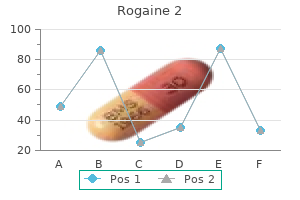 generic 60ml rogaine 2 fast delivery