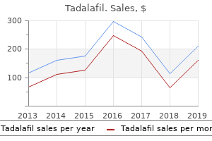 buy 10 mg tadalafil with amex